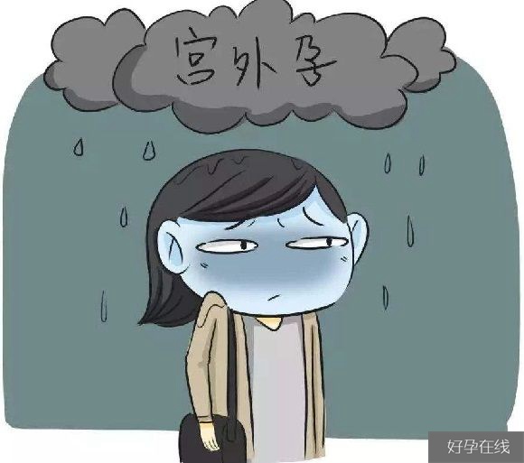 宫外孕或致盆腔粘连