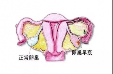 北京备孕试管婴儿知识_为什么年轻女性也会卵巢早衰？如何防止早衰？